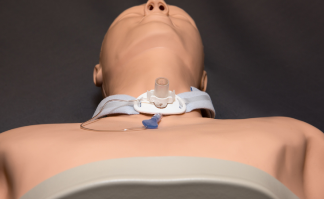 Know about Tracheostomy