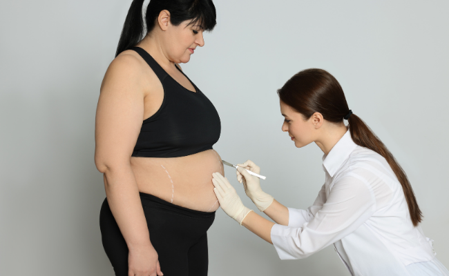Know about Weight Loss Surgery