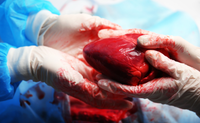 Know about Heart Transplant