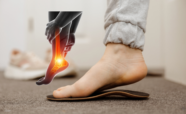 How to Treat Plantar Fasciitis?