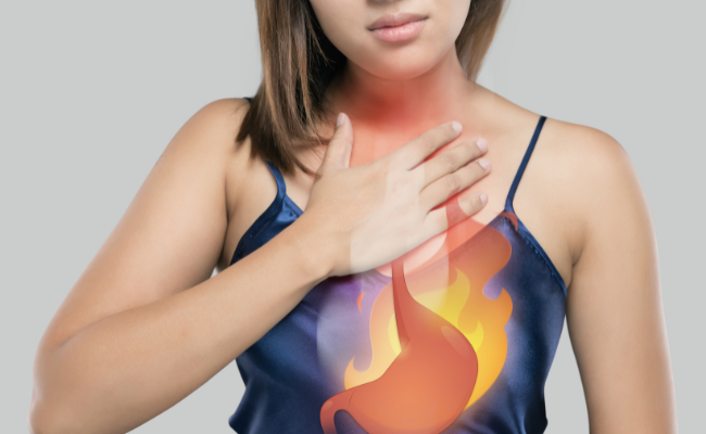 How to Treat Heartburn?