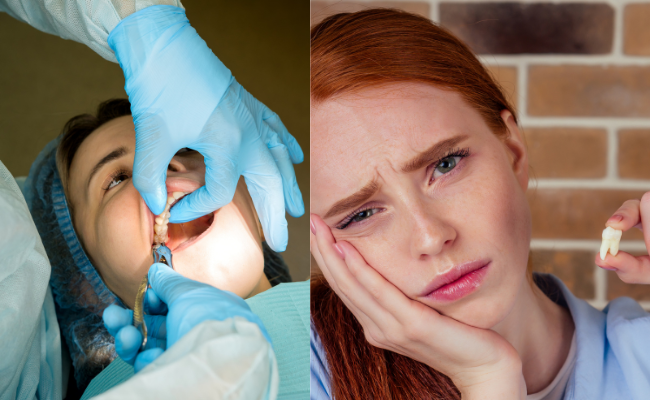 Know about Wisdom Tooth Removal