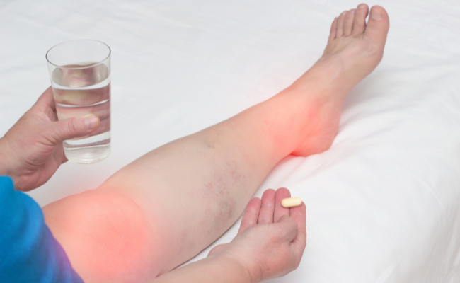 How to Treat Lymphoedema?