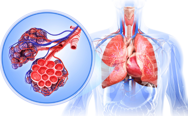 How to Treat Cystic Fibrosis?