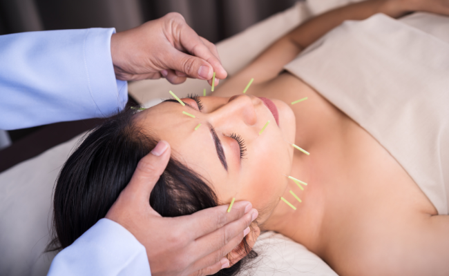 Know about Acupuncture