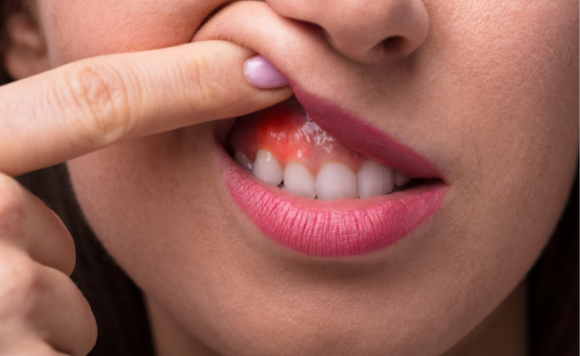 How to Treat Gum Pain?
