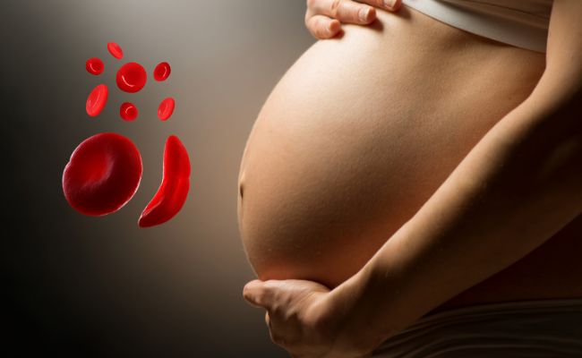 How to Treat Anaemia In Pregnancy?