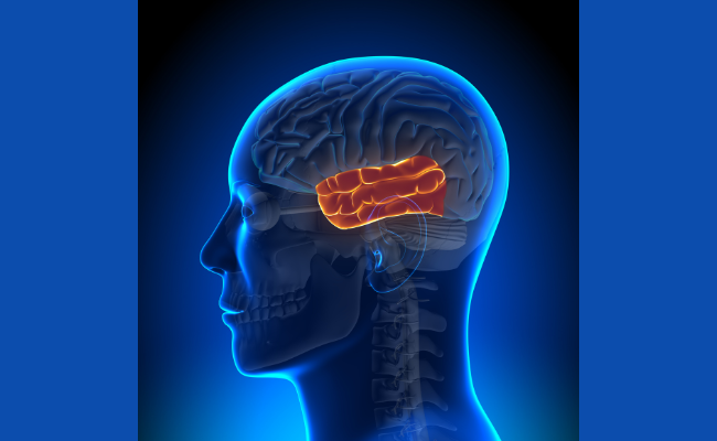 How to Treat Temporal Arteritis?