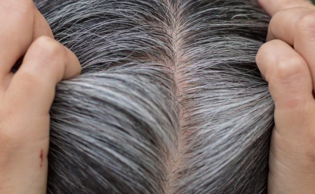 How to Treat Premature Grey Hair?