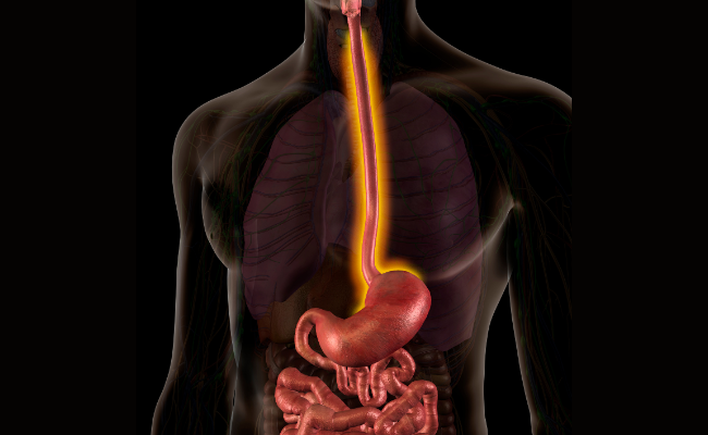 How to Treat Achalasia?