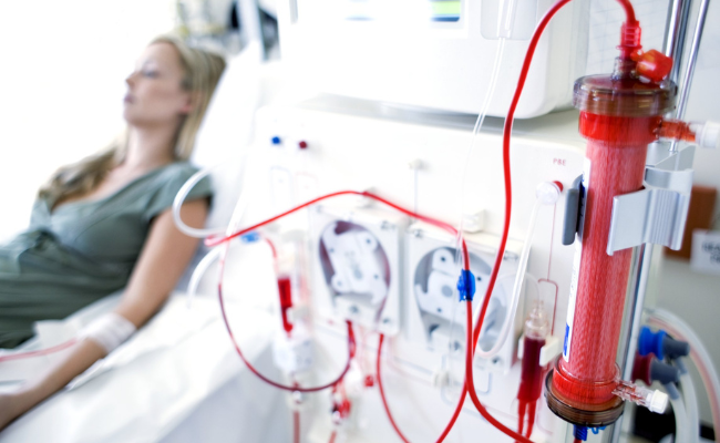 Know about Dialysis