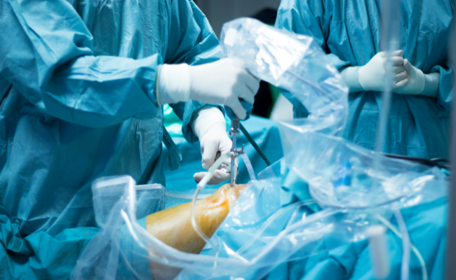 Know about Arthroscopy