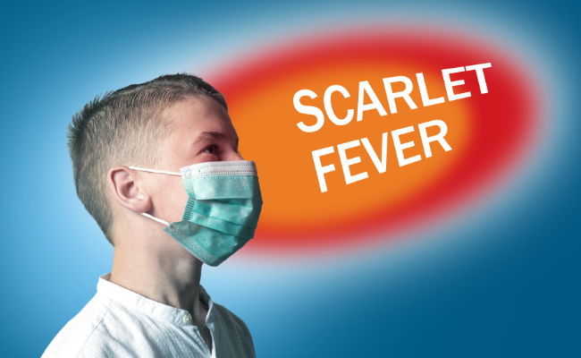 Scarlet Fever Recognizing Symptoms And Effective Treatment