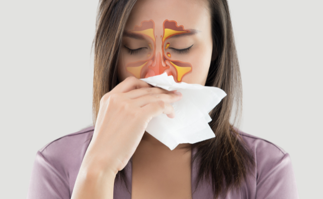 How to Treat Non Allergic Rhinitis?