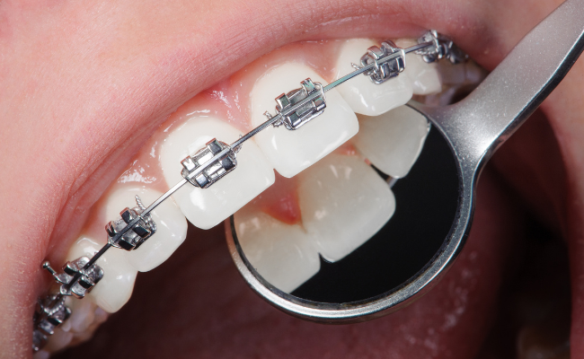 Know about Orthodontics