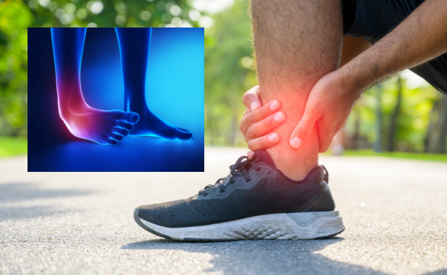 How to Treat a Sprained Ankle?