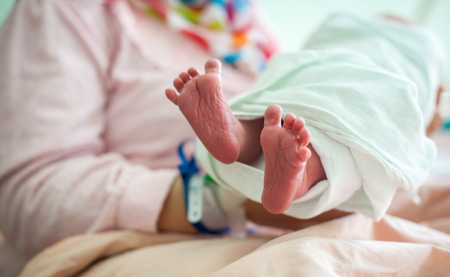 How to Treat Neonatal Feet Oedema?