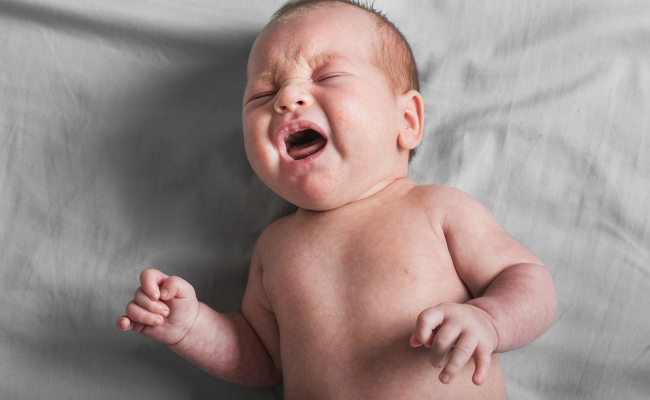 Colic In Infants: Causes, Symptoms, And Care Strategies