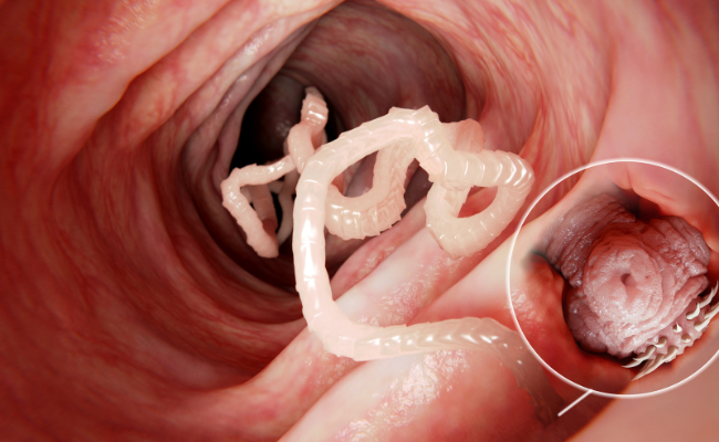 How to Treat Tapeworms?