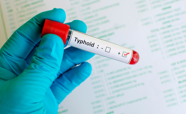 How to Treat Typhoid Fever?