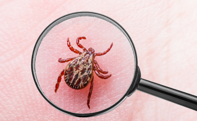 How to Treat Tick Bite Fever?