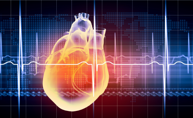 How to Treat Supraventricular Tachycardia?