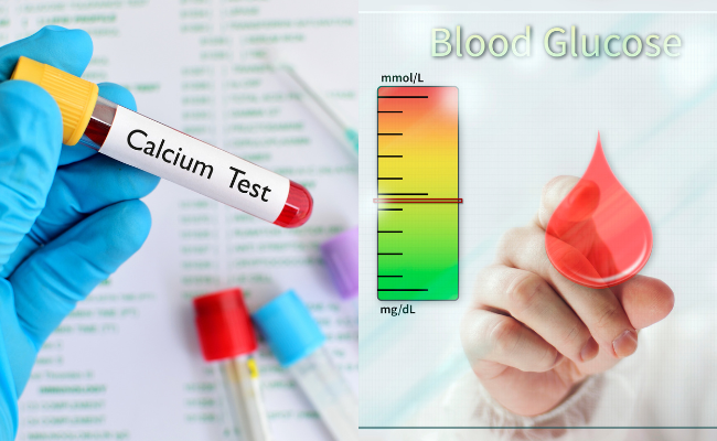 How to Treat Hypercalcaemia?