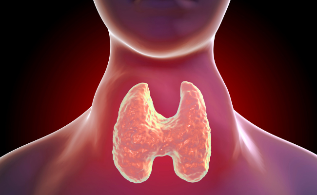 How to Treat Graves Hyperthyroidism?