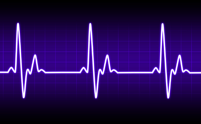 Irregular Heartbeat: Causes and Symptoms