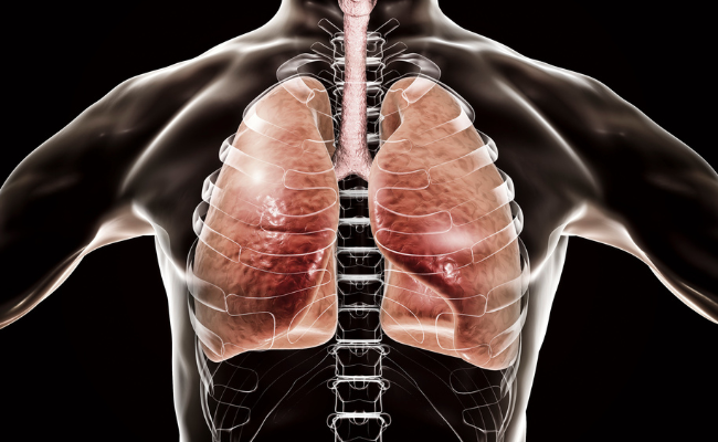 How to Treat Chronic Obstructive Pulmonary Disease?