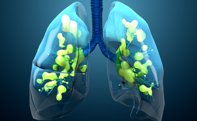 How to Treat Severe Acute Respiratory Syndrome?