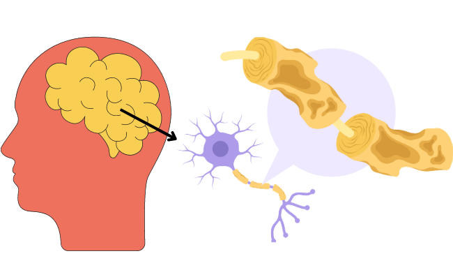 How to Treat Neuromyelitis Optica?