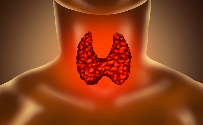 How to Treat Thyroid Gland Problems?