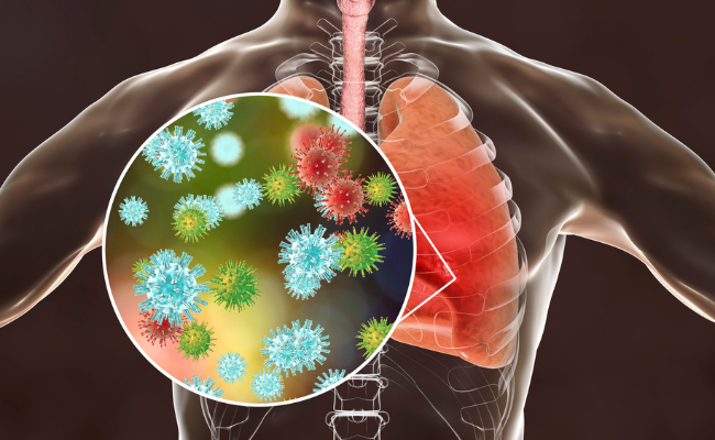 How to Treat Middle East Respiratory Syndrome?