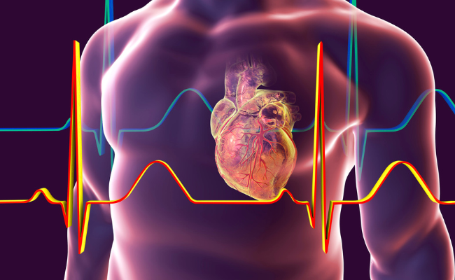 How to Treat Brugada Syndrome?