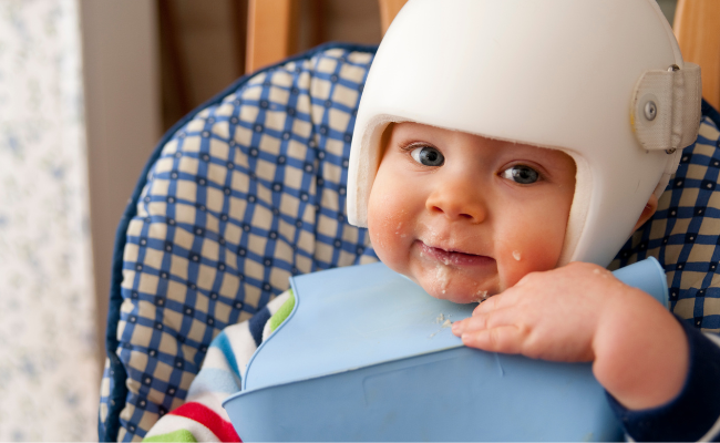 How to Treat Brachycephaly And Plagiocephaly?