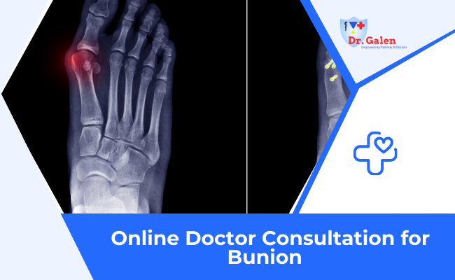 Online Doctor Consultation for Bunion