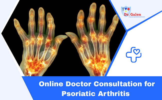 Online Doctor Consultation for Psoriatic Arthritis