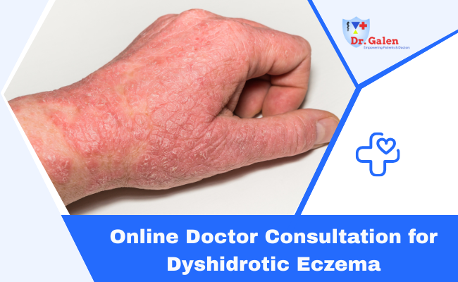 Online Doctor Consultation for Dyshidrotic Eczema