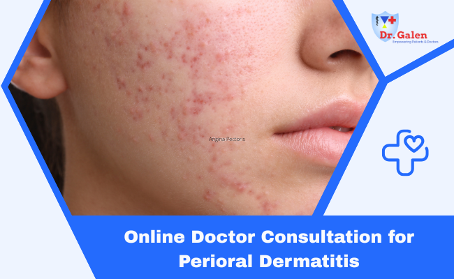 Online Doctor Consultation for Perioral Dermatitis