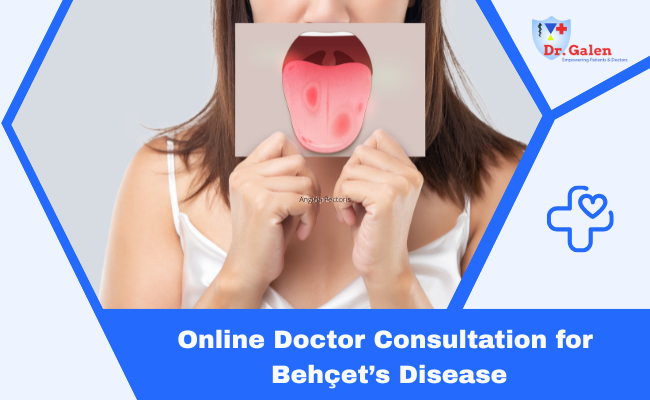 Online Doctor for Behçet’s Disease
