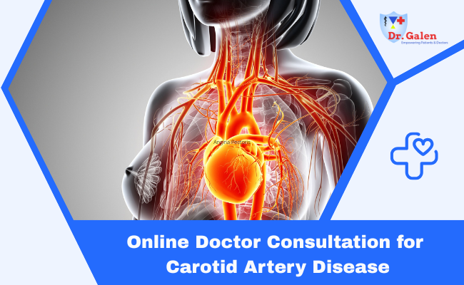 Online Doctor Consultation for Carotid Artery Disease