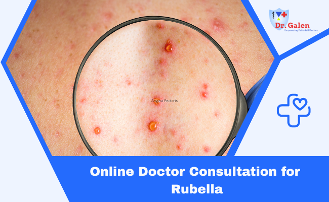 Online Doctor Consultation for Rubella