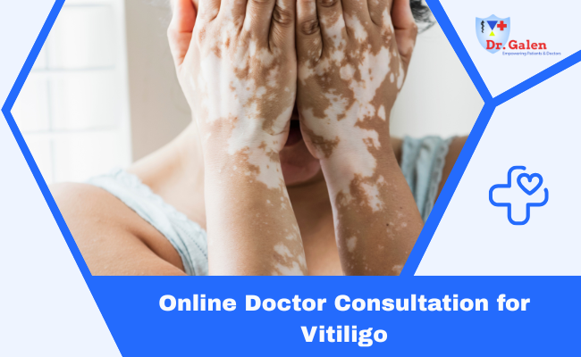 Online Doctors for Vitiligo