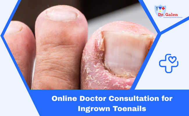 Online Doctors for Ingrown Toenails