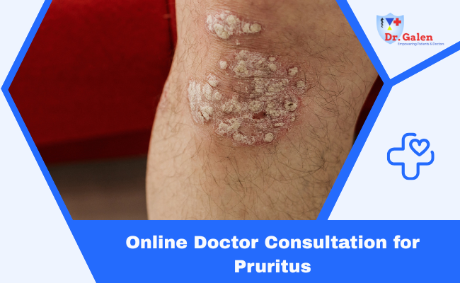 Online Doctors for Pruritus