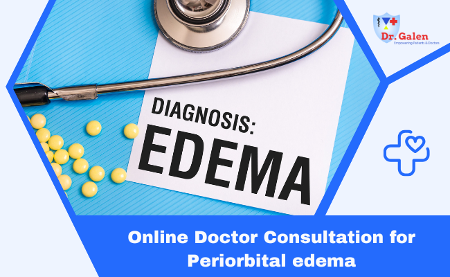 Online Doctor Consultation for Periorbital Edema