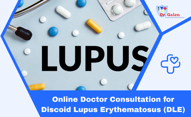 Online Doctor Consultation for Discoid Lupus Erythematosus