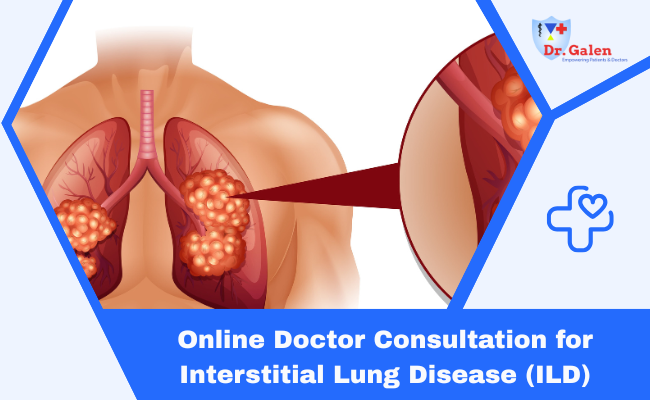Online Doctor Consultation for ILD