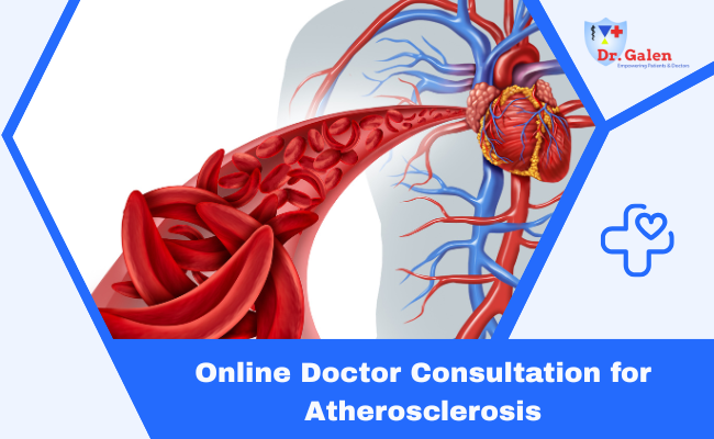 Online Doctor Consultation for Atherosclerosis